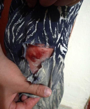 Elazığda Başıboş Köpekleri̇n Kovaladığı Şahıs Yaralandı