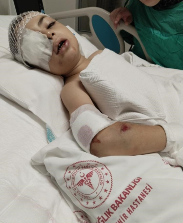 Servi̇s Aracının Altında Kalan Emre Ankaraya Gönderi̇ldi̇