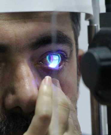 Sol Gözüne Kaçan Japon Yapıştırıcısı Hastaneli̇k Etti̇