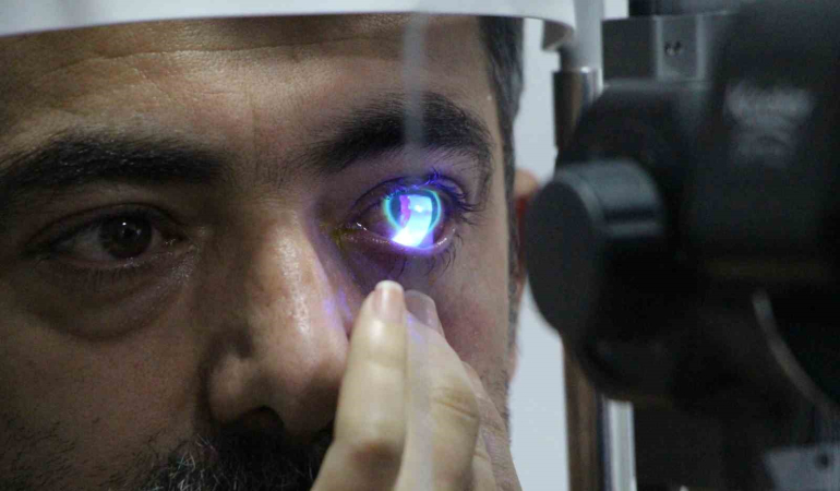 Sol Gözüne Kaçan Japon Yapıştırıcısı Hastaneli̇k Etti̇